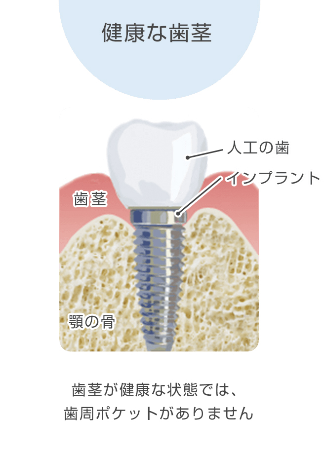 レベル0